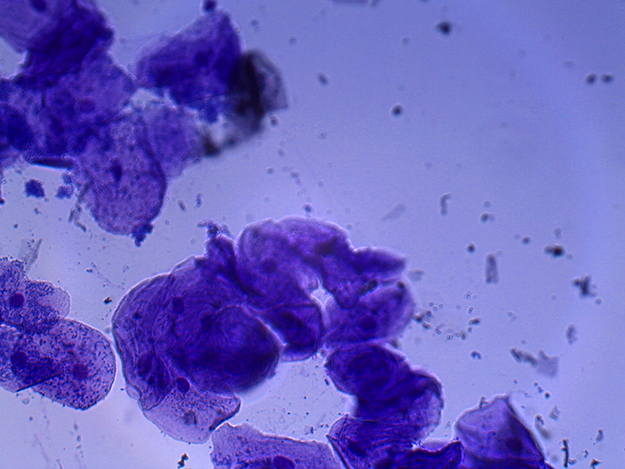 Microscopic image of epithelial cells stained purple from a human mouth